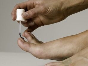 Nail fungal treatment