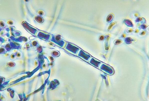The fungus Trichophyton rubrum under the microscope