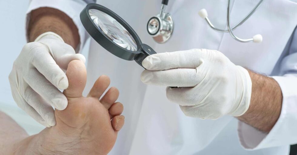 the doctor examines the foot for fungus